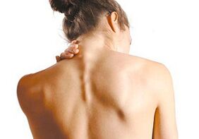 How cervical osteochondrosis manifests