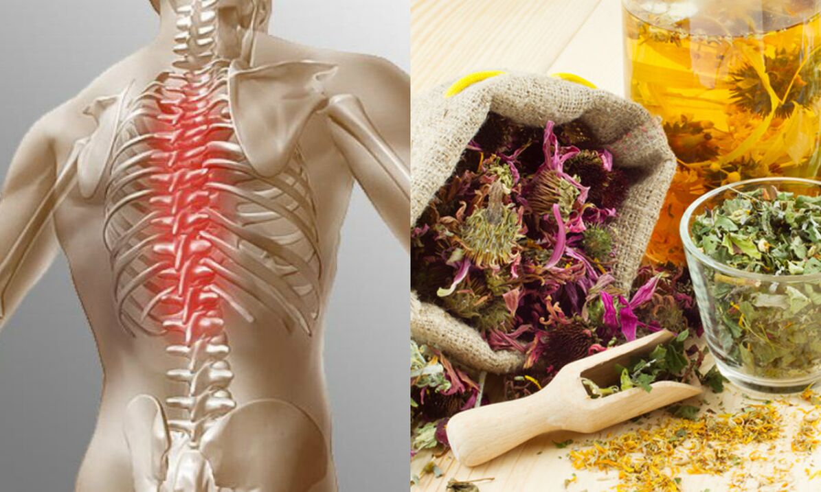 osteochondrosis of the neck folk methods